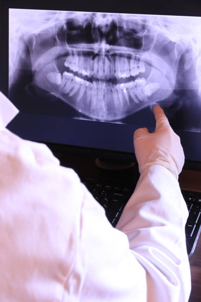 Best Emergency Root Canal Treatment in Coupeville, WA
